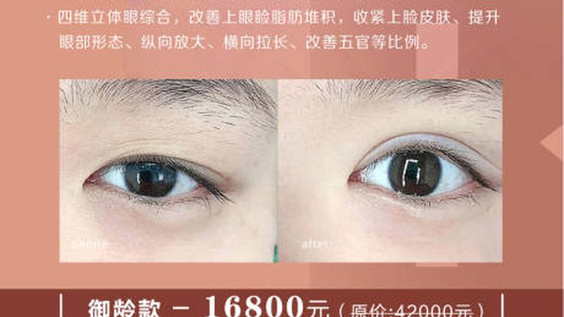 肉毒素注射后，这些禁忌你了解吗？**