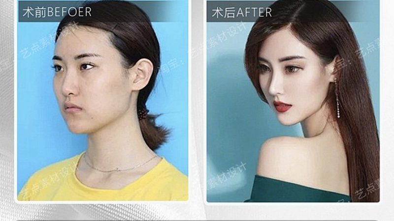 医美咨询师资格证：考取之路与职业发展