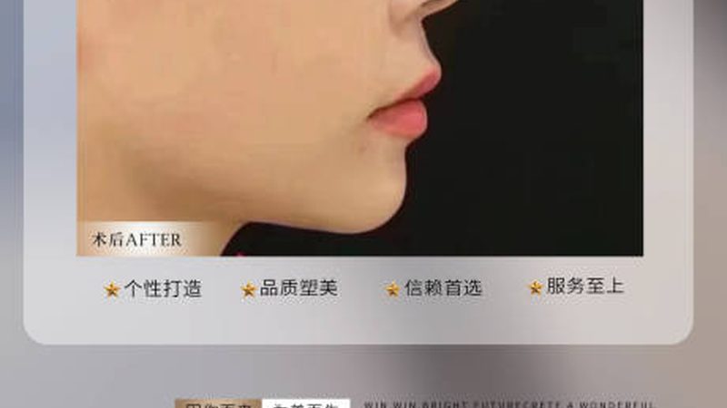 小标题：超声炮术后恢复期注意事项