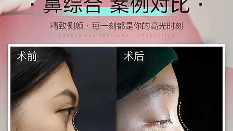 面部抗衰医美项目排名前十
