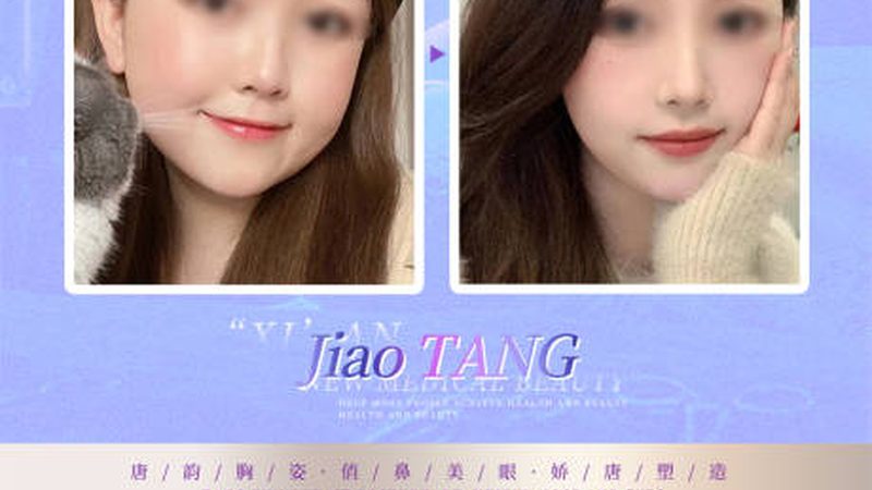 术后初期：注意休息，避免剧烈运动